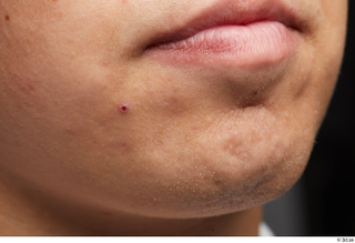  HD Face Skin Jerome chin face head lips mouth skin pores skin texture 0003.jpg